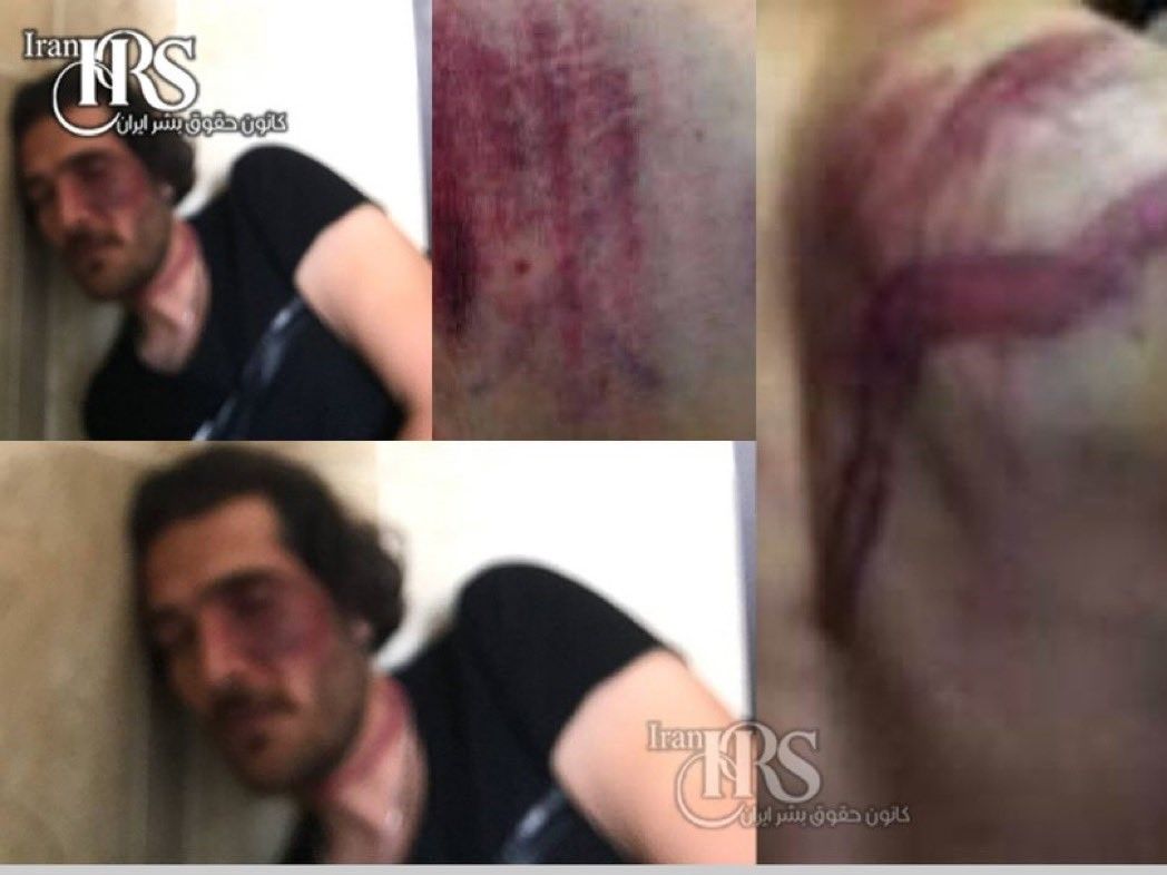 Photos showing Firouzi's injuries in custody. January 2023