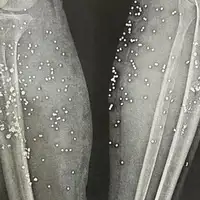 They carry the evidence of Iran’s crackdown on their bodies