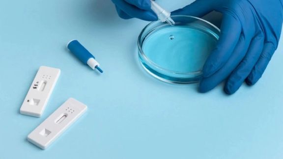 سخنگوی کمیسیون بهداشت مجلس: ۱۵۰ هزار کیت تشخیص تب دنگی از یکسال پیش در گمرک معطل است