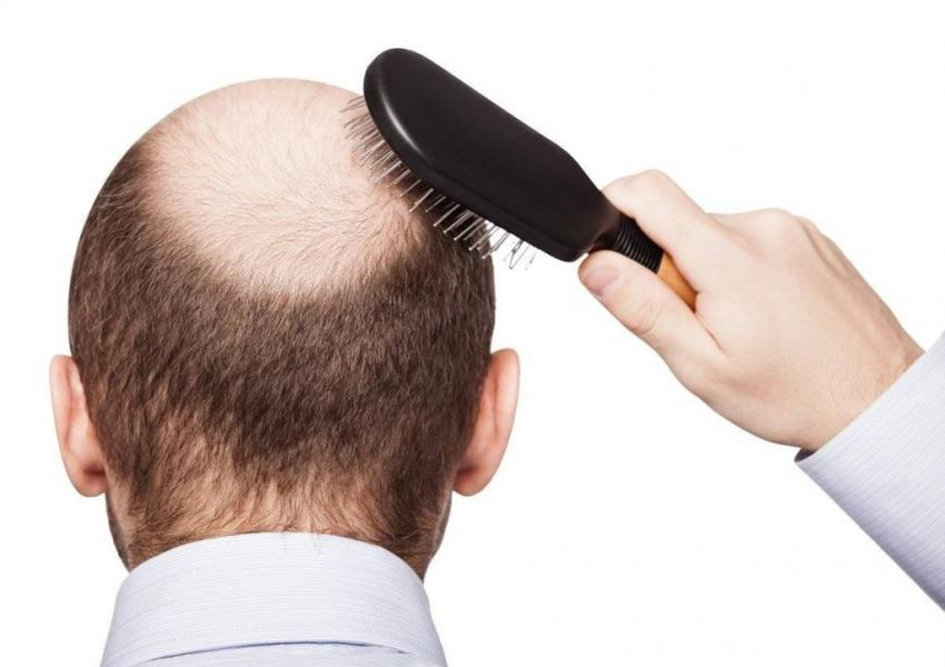 آنچه درباره کمبود اسید معده نمی‌دانید؛ از مشکلات گوارشی تا ریزش مو