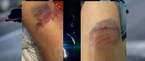 مهسا رازانی همسر روحالله زم در فرانسه مورد ضرب و جرح یک موتورسوار قرار گرفت