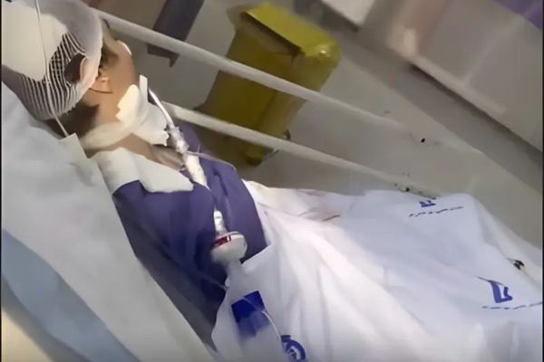 اهتمام إعلامي دولي بحالة مراهقة إيرانية تعرضت لاعتداء.. وأصابع الاتهام تتجه لشرطة الأخلاق