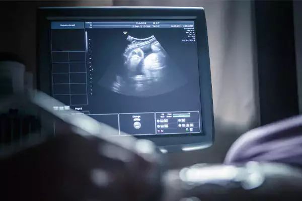 واکنش‌ها به توقف تولید و واردات کیت‌های غربالگری؛ احتمال تولد نسلی با ناهنجاری ژنتیکی 