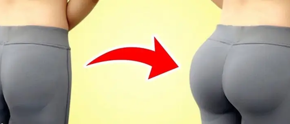 An image used by an Iranian clinic to promote gluteoplasty