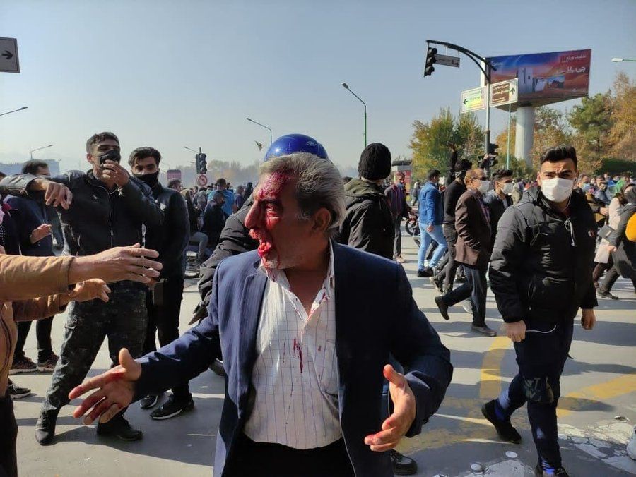 A protester in Esfahan, Iran targeted by a shotgun bleeding in the face. November 26, 2021