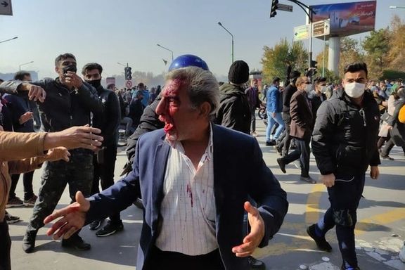 A man shot with shotgun 'bird shots' in Esfahan on November 26, 2021