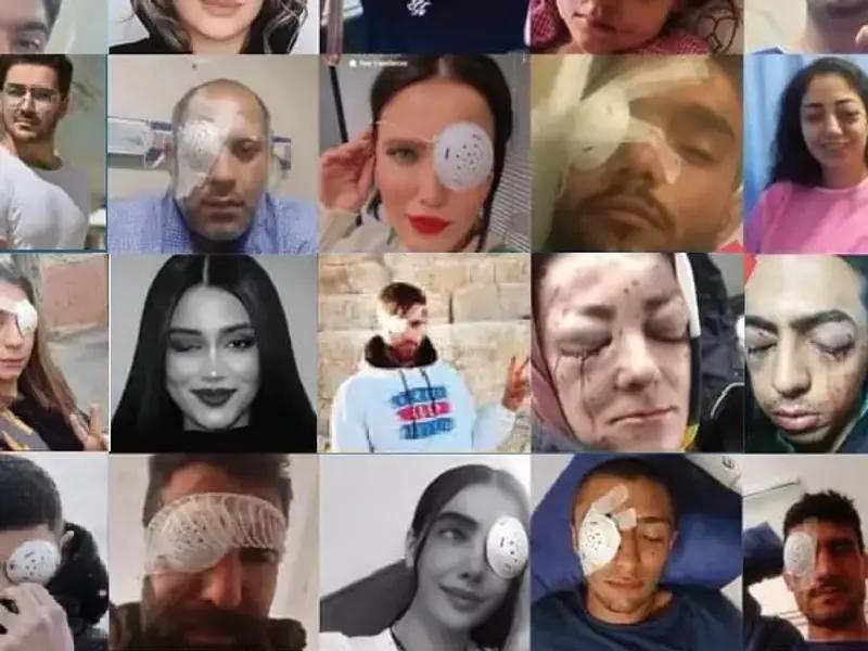 منظمة حقوق الإنسان الإيرانية تعلن عن 138 إصابة على الأقل في العين برصاص نظام طهران