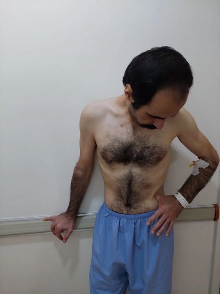 تصویری از حسین رونقی بعد از ۶۴ روز اعتصاب غذا