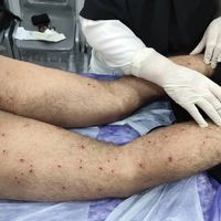 وقتی درمان «جرم» میشود؛ روایت نیویورکر از ایستادگی پزشکان در برابر سرکوب جمهوری اسلامی