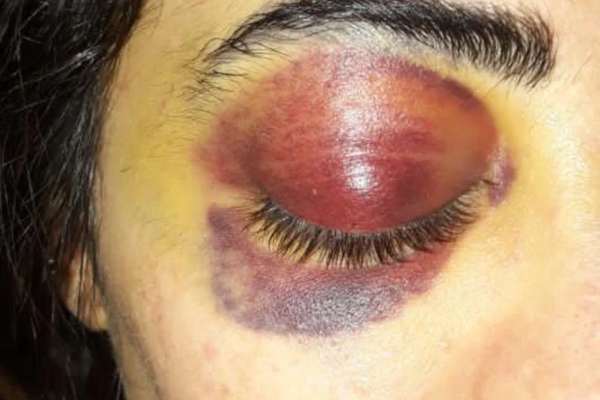 Iranian Female Protester Sentenced To 11 Years And Washing Graves