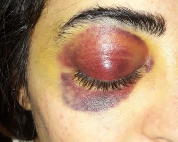 Iranian Female Protester Sentenced To 11 Years And Washing Graves