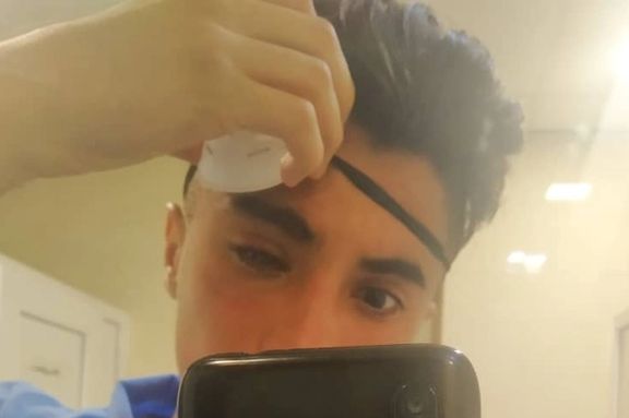 متین حسنی، از مجروحان چشمی اعتراضات اعلام کرد که بیمارستان به او برای رسیدگی وقت نمیدهد