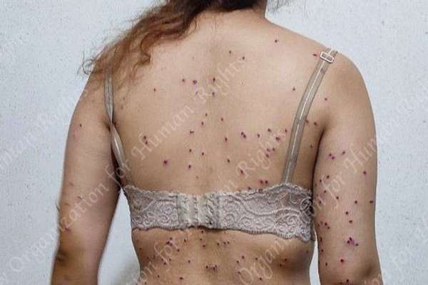 British-Iranian Health Worker Shot By Security Forces During Protests