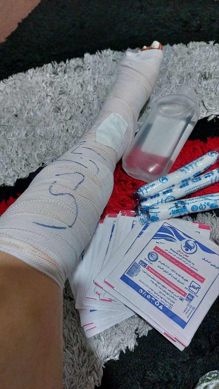 A bandaged leg of an Iranian woman with the word ‘freedom’ written on it 