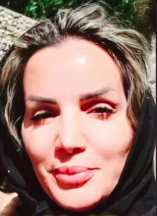 فاطمه امام‌دوست با شلیک گلوله جنگی به سرش در مشهد کشته شد