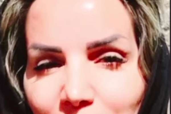فاطمه امامدوست با شلیک گلوله جنگی به سرش در مشهد کشته شد