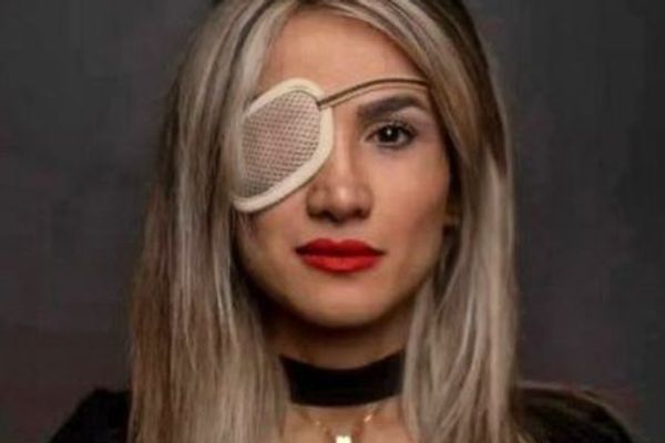 Blinded protestor says Iran's fight has moved beyond the hijab