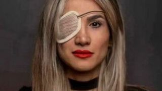 Blinded protestor says Iran's fight has moved beyond the hijab