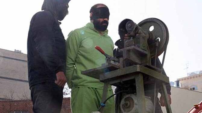 Leading Iranian Surgeon Speaks Out Against Chopping Off Fingers