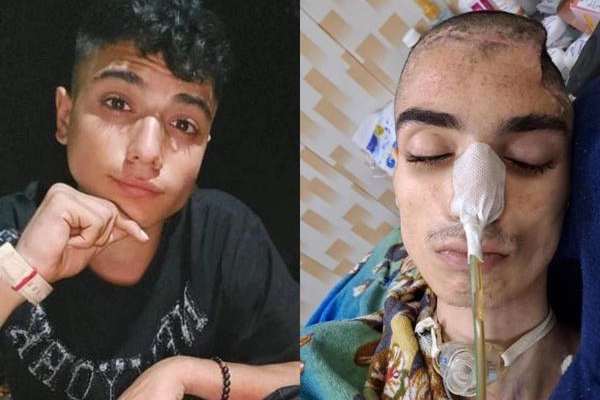 Iranian Teenager Shot In Head During Protests Succumbs To Injuries