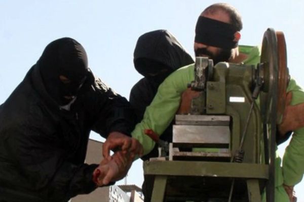 Iranian Finger Amputations Continue Against International Law