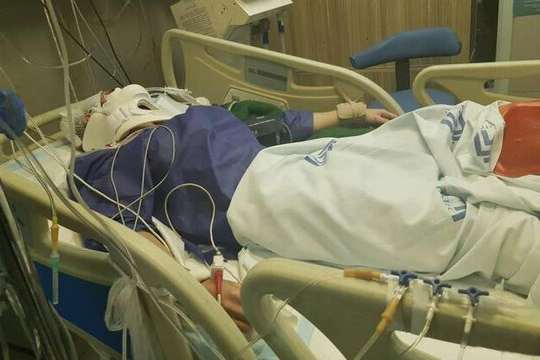 Iranian teenager, identified as Hamza, sustained a brain injury in a motorbike accident in May, following which a part of his skull was removed to relieve pressure on his brain from swelling.