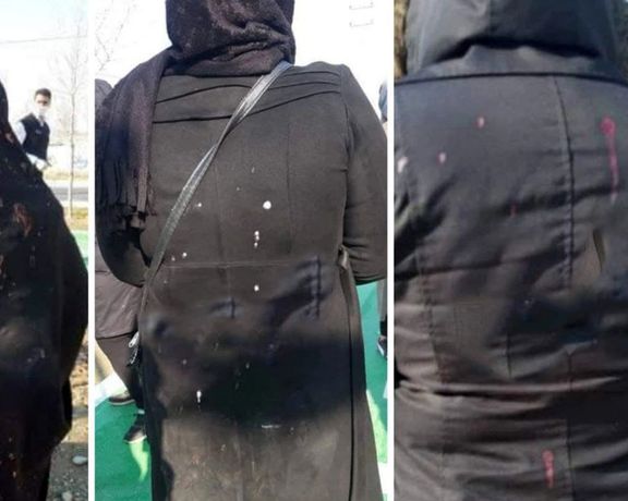 وبسایت رکنا گزارش داد یک مرد در پارکی در شهریار به چند زن اسید پاشیده است