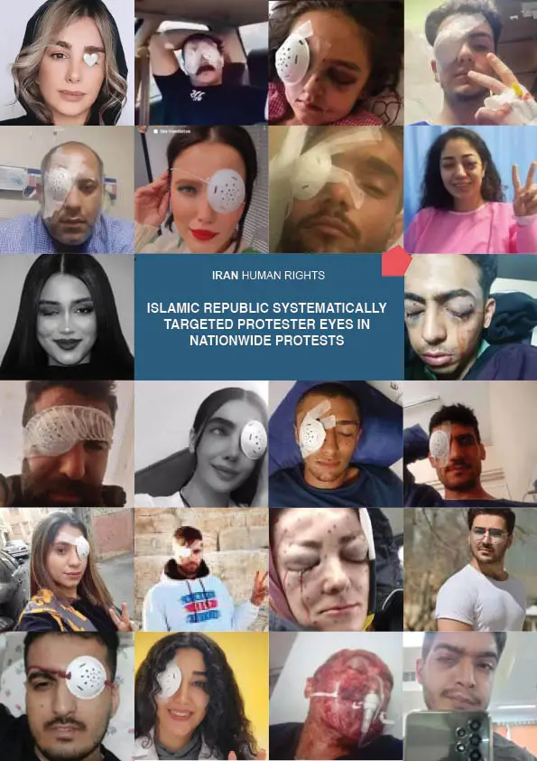 آسیب‌‌دیدگان چشمی اعتراض‌ها، حالا با نبود دارو و درمان شکنجه می‌شوند