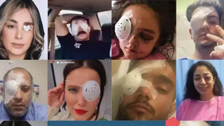 آسیبدیدگان چشمی اعتراضها، حالا با نبود دارو و درمان شکنجه میشوند