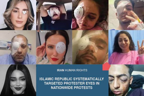 Investigation Finds Dozens Of Iranian Protesters Lost Their Eyes