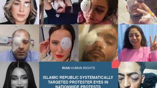 Investigation Finds Dozens Of Iranian Protesters Lost Their Eyes