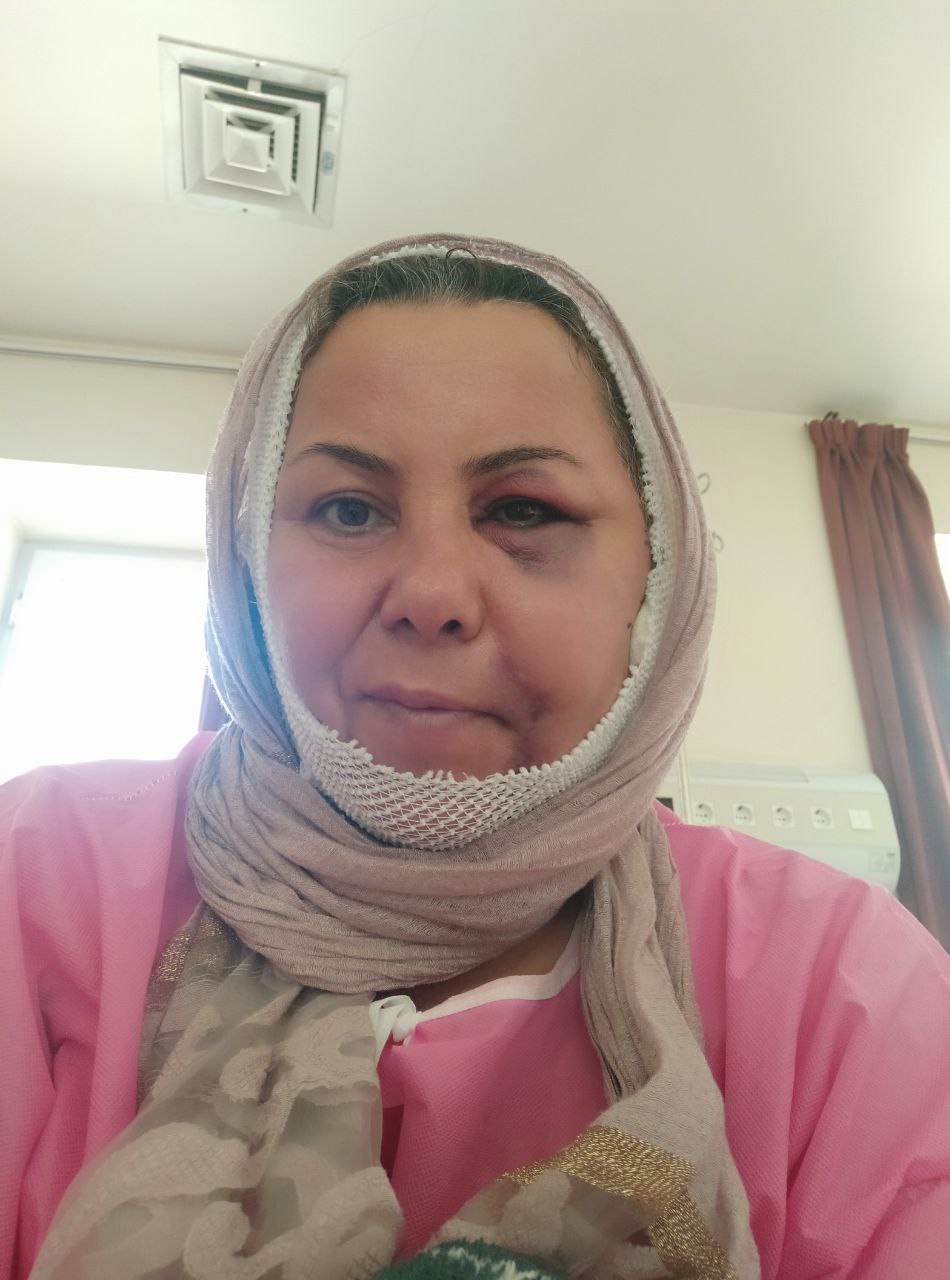 ناپدید شدن پدر یک خانواده در بوکان پس از زخمی شدن همسرش در جریان جنبش مهسا