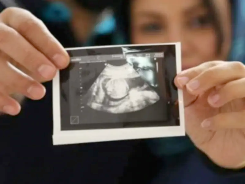 شواهدی از افزایش اختلالات شدید کروموزومی بعد از اعمال قانون جوانی جمعیت