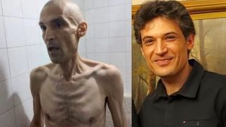 World Outraged By Shocking Photos Of Hunger-Striking Political Prisoner