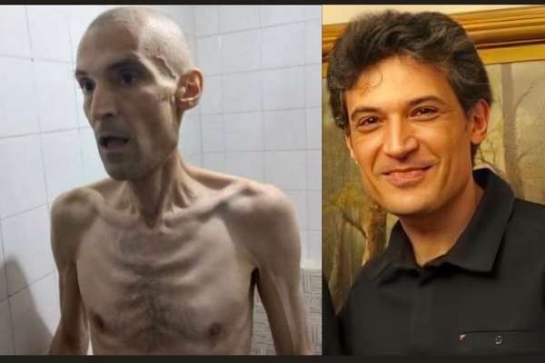 World Outraged By Shocking Photos Of Hunger-Striking Political Prisoner