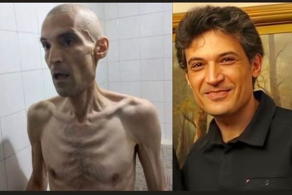 World Outraged By Shocking Photos Of Hunger-Striking Political Prisoner