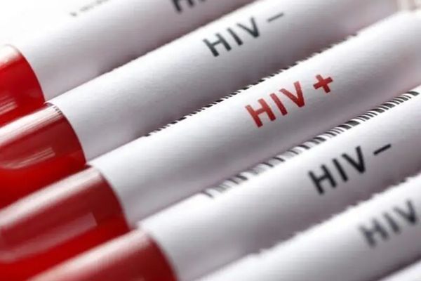 في اليوم العالمي للإيدز.. "الصحة" الإيرانية: ارتفاع كبير في عدد المصابات النساء