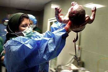 وزارت بهداشت دستور جلوگیری از سزارینهای غیر اورژانسی در روز ۲/۲/۱۴۰۲ را داد