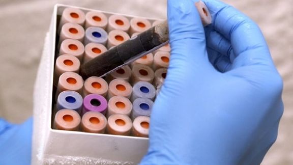 The UK launches the largest clinical trial of a blood test capable of detecting cancer early